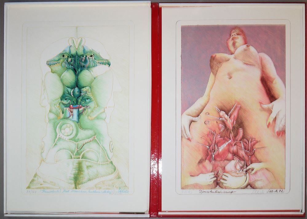 0441-Wolfgang Schlick, Transplants, 9 Zinklithographien in Kassette, Draier-Verlag, 1972 – Bild 4