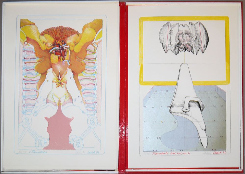 0441-Wolfgang Schlick, Transplants, 9 Zinklithographien in Kassette, Draier-Verlag, 1972 – Bild 6