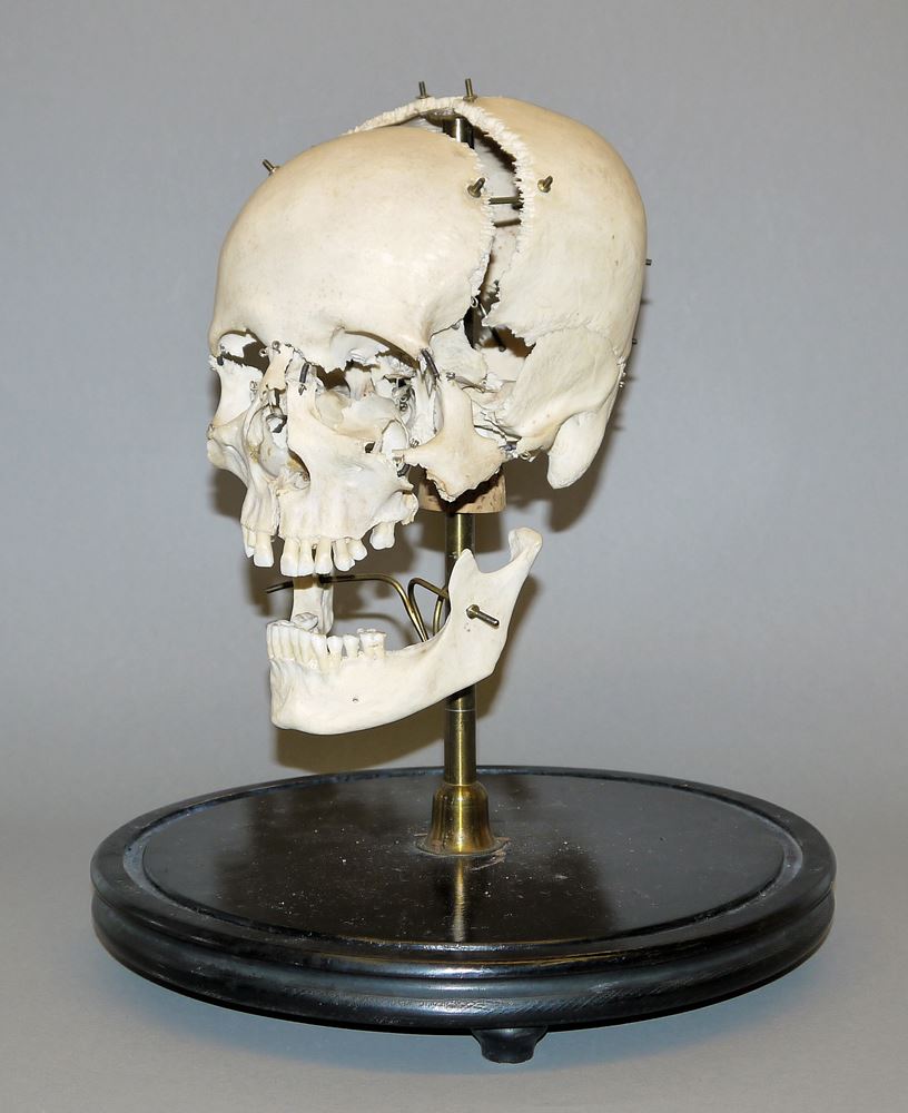1068-Außergewöhnlicher anatomischer Schädel mit Glassturz, 19. Jh. – Bild 2