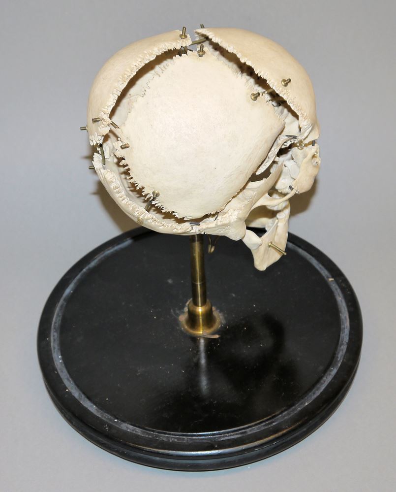 1068-Außergewöhnlicher anatomischer Schädel mit Glassturz, 19. Jh. – Bild 3