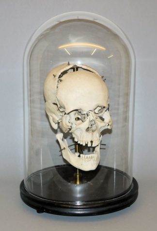 1068-Außergewöhnlicher anatomischer Schädel mit Glassturz, 19. Jh.