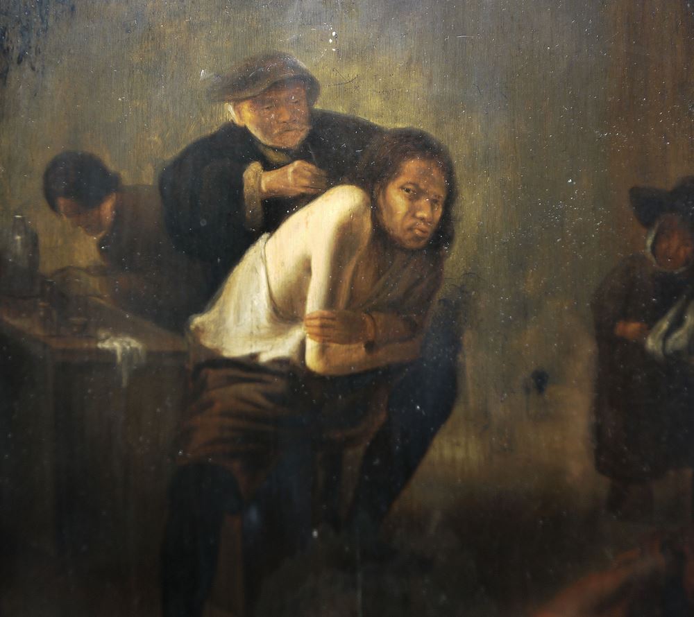 0675-Gerrit Lundens, zugeschr./ Atelier, "Die Schulteroperation", Ölgemälde des späten 17. Jh. – Bild 2