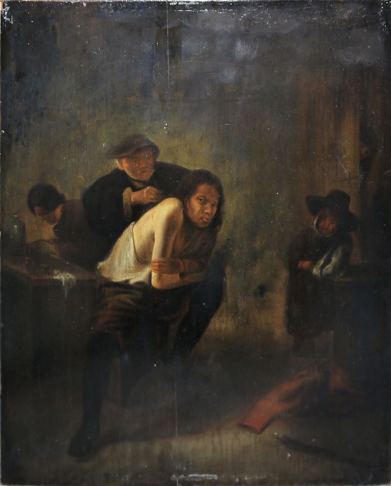 0675-Gerrit Lundens, zugeschr./ Atelier, „Die Schulteroperation“, Ölgemälde des späten 17. Jh.